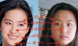 爆料刘亦菲整容视频,揭秘女神蜕变之谜